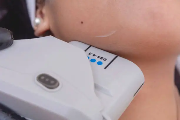 North_Hollywood_CA_Lingual_frenectomy