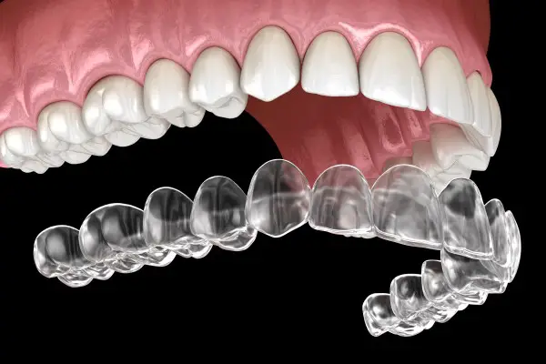 North_Hollywood_CA_invisalign